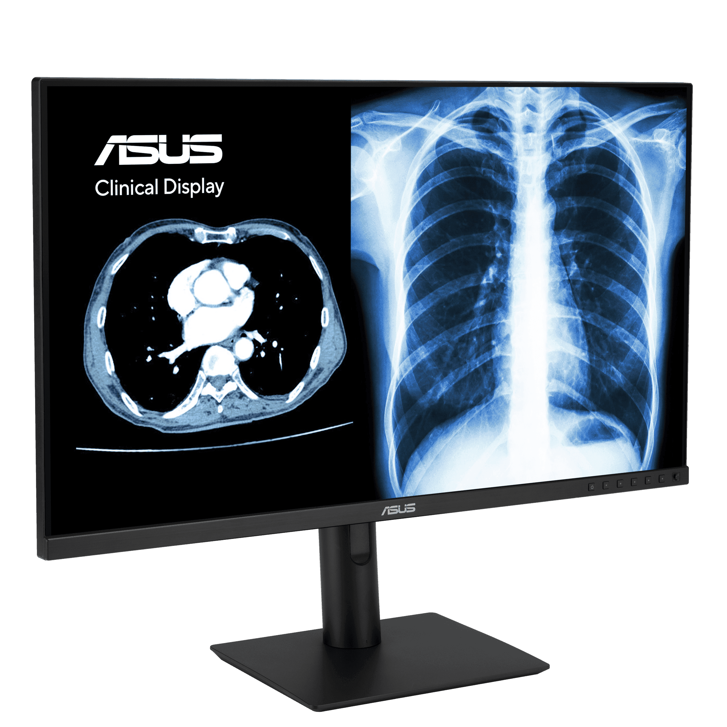 ASUS Advances Healthcare Technology with AI-Powered Medical Displays at MEDICA 2024