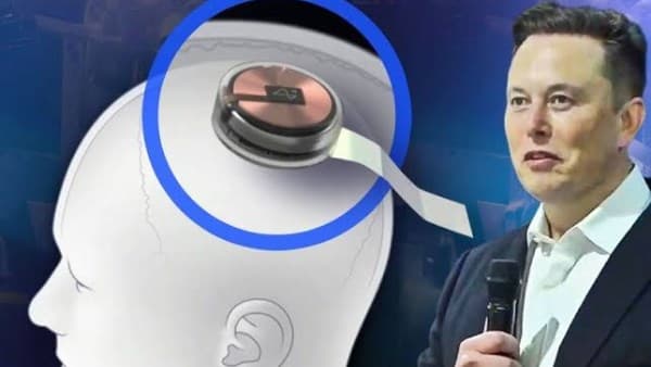 China’s BrainCo pushes wearable BCI as non‑invasive alternative to Neuralink
